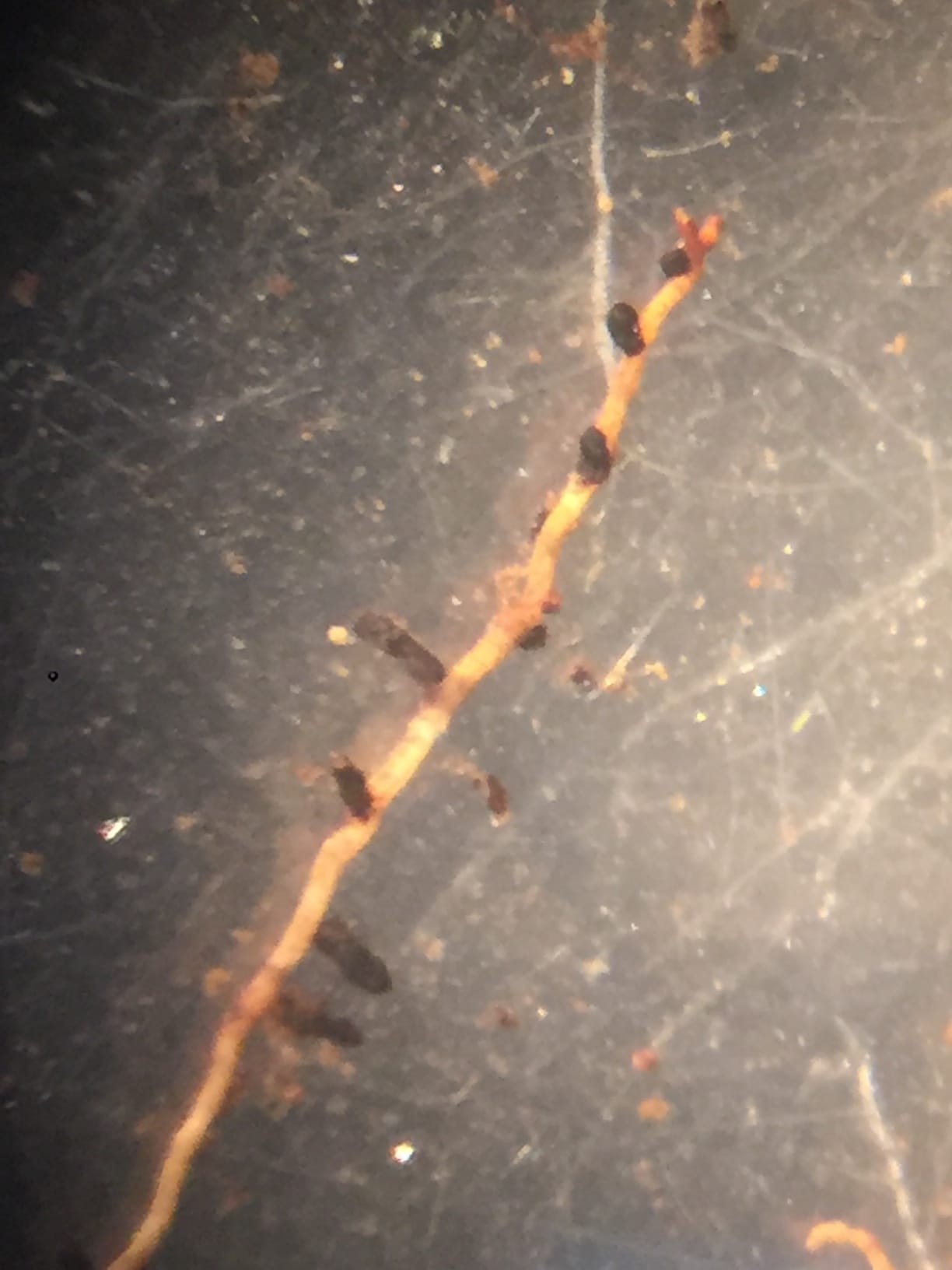 Black ectomycorrhizae cover birch root tips in this photo taken under the microscope.